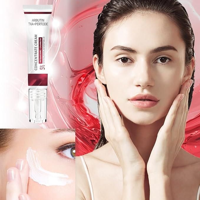 Melasma Spotless Concentrate Cream 100 gm Pack of 2