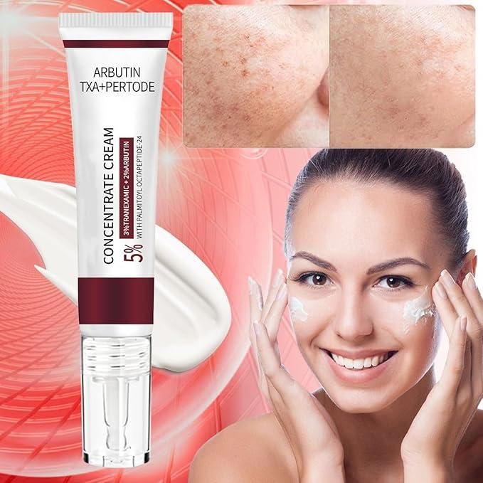 Melasma Spotless Concentrate Cream 100 gm Pack of 2