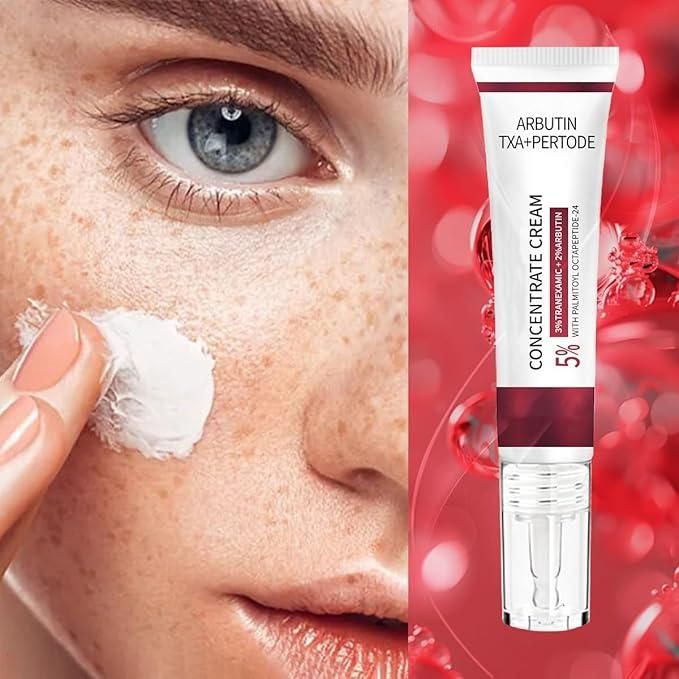 Melasma Spotless Concentrate Cream 100 gm Pack of 2